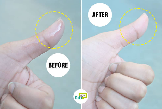 how to get second skin adhesive off