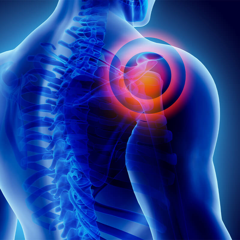 how to get rid of gas pain in shoulder